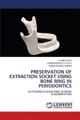 Preservation of Extraction Socket Using Bone Ring in Periodontics - K Shiva Teja,Chakravarthy Y S H S,Jannu Rajeev Naren - cover