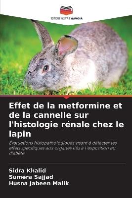 Effet de la metformine et de la cannelle sur l'histologie rénale chez le lapin - Sidra Khalid,Sumera Sajjad,Husna Jabeen Malik - cover
