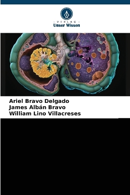 ibs