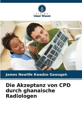 Die Akzeptanz von CPD durch ghanaische Radiologen - James Newlife Kwadzo Gawugah - cover