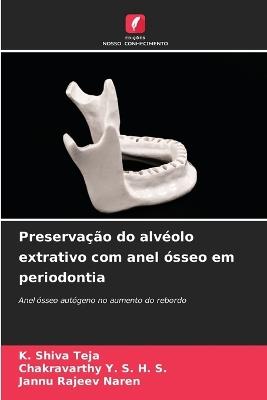 Preservação do alvéolo extrativo com anel ósseo em periodontia - K Shiva Teja,Chakravarthy Y S H S,Jannu Rajeev Naren - cover