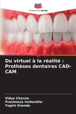 Du virtuel à la réalité: Prothèses dentaires CAD-CAM - Vidya Channe,Prashnasa Vaikunthe,Yogini Shende - cover