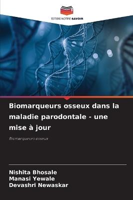 Biomarqueurs osseux dans la maladie parodontale - une mise à jour - Nishita Bhosale,Manasi Yewale,Devashri Newaskar - cover