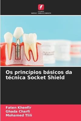 Os princípios básicos da técnica Socket Shield - Faten Khenfir,Ghada Charfi,Mohamed Tlili - cover