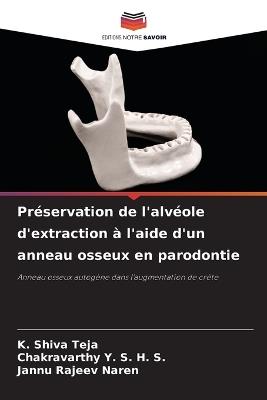 Préservation de l'alvéole d'extraction à l'aide d'un anneau osseux en parodontie - K Shiva Teja,Chakravarthy Y S H S,Jannu Rajeev Naren - cover