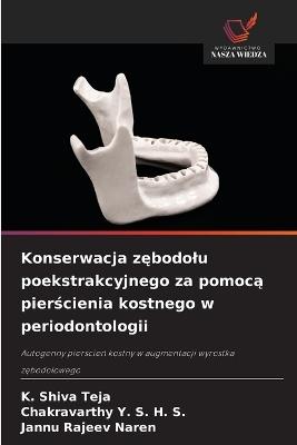 Konserwacja zębodolu poekstrakcyjnego za pomocą pierścienia kostnego w periodontologii - K Shiva Teja,Chakravarthy Y S H S,Jannu Rajeev Naren - cover