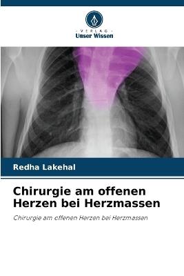 Chirurgie am offenen Herzen bei Herzmassen - Redha Lakehal - cover