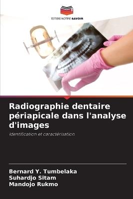 Radiographie dentaire périapicale dans l'analyse d'images - Bernard Y Tumbelaka,Suhardjo Sitam,Mandojo Rukmo - cover