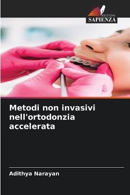 Metodi non invasivi nell'ortodonzia accelerata - Adithya Narayan - cover