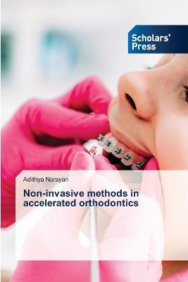 Non-invasive methods in accelerated orthodontics - Adithya Narayan - cover
