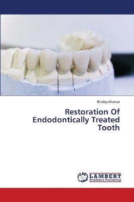 Restoration Of Endodontically Treated Tooth - Bindiya Kumar - cover