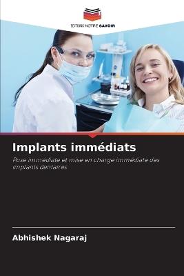 Implants immédiats - Abhishek Nagaraj - cover
