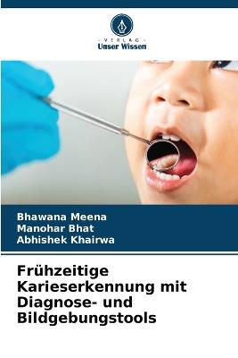 Frühzeitige Karieserkennung mit Diagnose- und Bildgebungstools - Bhawana Meena,Manohar Bhat,Abhishek Khairwa - cover