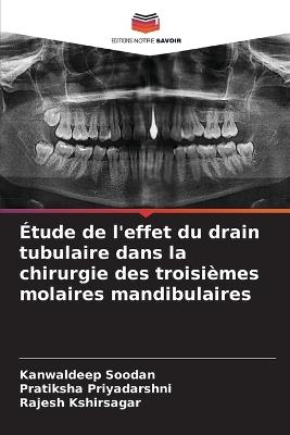 Étude de l'effet du drain tubulaire dans la chirurgie des troisièmes molaires mandibulaires - Kanwaldeep Soodan,Pratiksha Priyadarshni,Rajesh Kshirsagar - cover