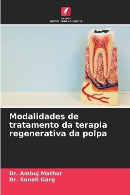 Modalidades de tratamento da terapia regenerativa da polpa - Ambuj Mathur,Sonali Garg - cover
