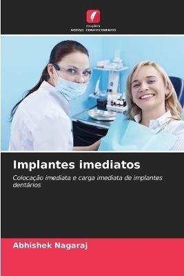 Implantes imediatos - Abhishek Nagaraj - cover