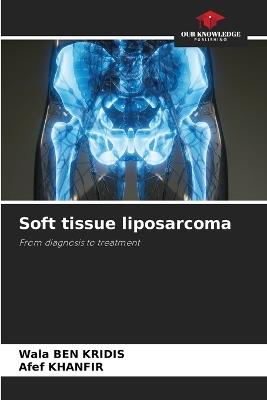 Soft tissue liposarcoma - Wala Ben Kridis,Afef Khanfir - cover