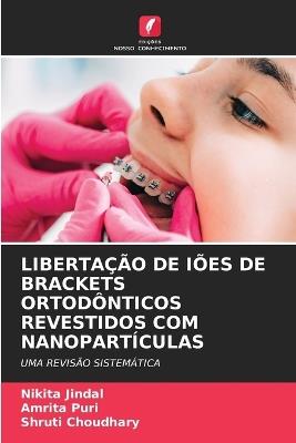 Libertação de Iões de Brackets Ortodônticos Revestidos Com Nanopartículas - Nikita Jindal,Amrita Puri,Shruti Choudhary - cover