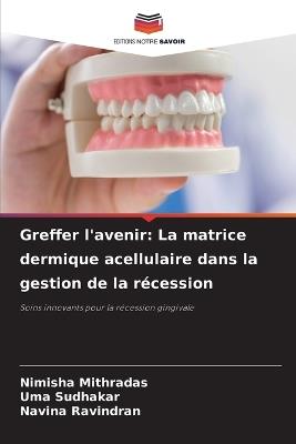 Greffer l'avenir: La matrice dermique acellulaire dans la gestion de la récession - Nimisha Mithradas,Uma Sudhakar,Navina Ravindran - cover