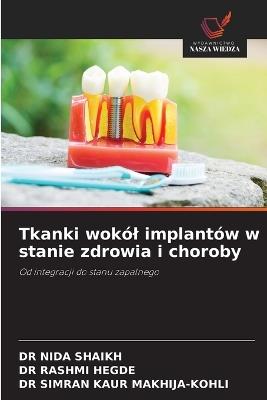 Tkanki wokól implantów w stanie zdrowia i choroby - Nida Shaikh,Rashmi Hegde,Simran Kaur Makhija-Kohli - cover