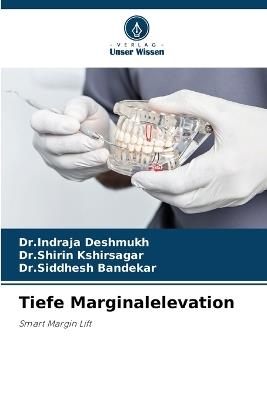 Tiefe Marginalelevation - Dr Indraja Deshmukh,Dr Shirin Kshirsagar,Dr Siddhesh Bandekar - cover