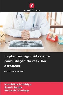 Implantes zigomáticos na reabilitação de maxilas atróficas - Hrashikesh Vaidya,Sumit Bedia,Mahesh Ghadage - cover