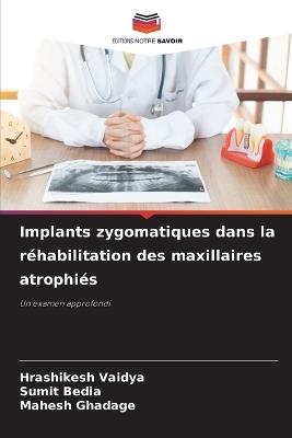 Implants zygomatiques dans la réhabilitation des maxillaires atrophiés - Hrashikesh Vaidya,Sumit Bedia,Mahesh Ghadage - cover
