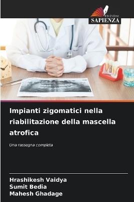 Impianti zigomatici nella riabilitazione della mascella atrofica - Hrashikesh Vaidya,Sumit Bedia,Mahesh Ghadage - cover