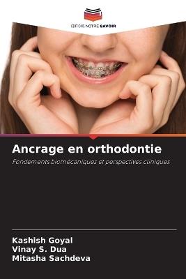 Ancrage en orthodontie - Kashish Goyal,Vinay S Dua,Mitasha Sachdeva - cover