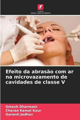 Efeito da abrasão com ar na microvazamento de cavidades de classe V - Umesh Dharmani,Charan Kamal Kaur,Ganesh Jadhav - cover