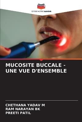 Mucosite Buccale - Une Vue d'Ensemble - Chethana Yadav M,Ram Narayan Bk,Preeti Patil - cover