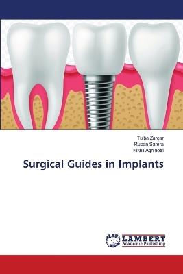 Surgical Guides in Implants - Tuiba Zargar,Rupan Samra,Nikhil Agnihotri - cover