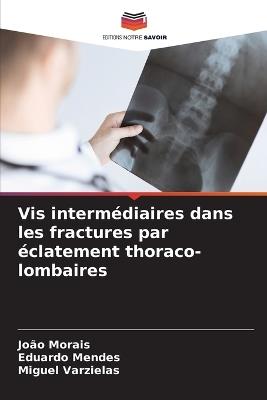 Vis intermédiaires dans les fractures par éclatement thoraco-lombaires - João Morais,Eduardo Mendes,Miguel Varzielas - cover