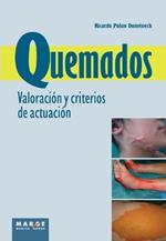 Quemados. Valoración y criterios de actuación