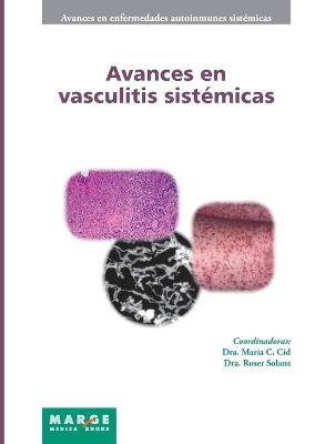 Avances en vasculitis sistémicas - Varios autores - cover