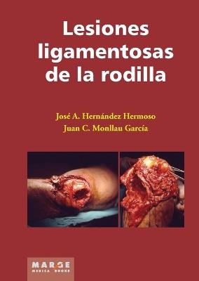 Lesiones ligamentosas de rodilla - Juan Monllau García,José Antonio Hernández Hermoso - cover