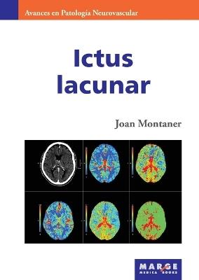 Ictus lacunar - Varios autores - cover