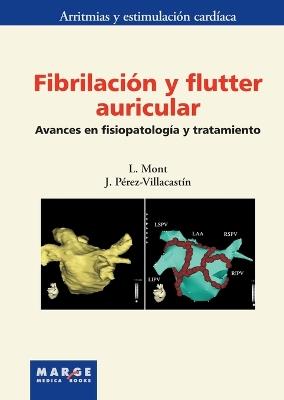 Fibrilación y flutter auricular - Josep Lluís Mont i Girbau,y otros - cover