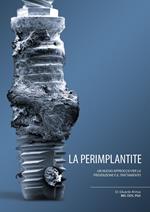 La perimplantite. Un nuovo approccio alla prevenzione e al suo trattamento