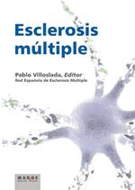 Esclerosis múltiple