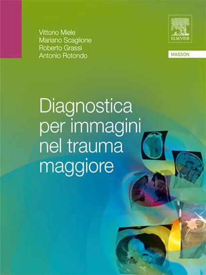 Diagnostica per immagini nel trauma maggiore - Roberto Grassi,Vittorio Miele,Antonio Rotondo,Mariano Scaglione - ebook