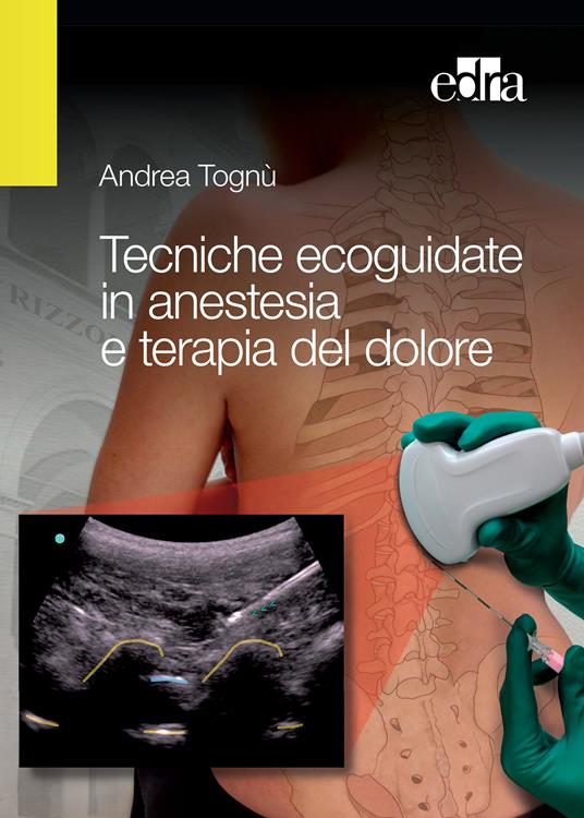 Tecniche ecoguidate in anestesia e terapia del dolore - Andrea Tognù - ebook