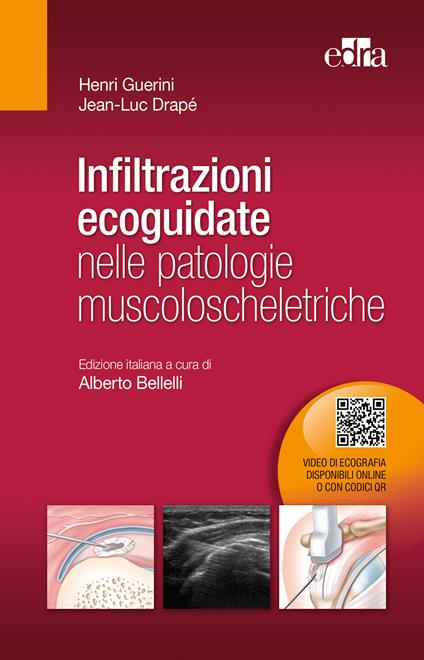 Infiltrazioni ecoguidate nelle patologie muscoloscheletriche - Jean-Luc Drapè,Henri Guerin - ebook