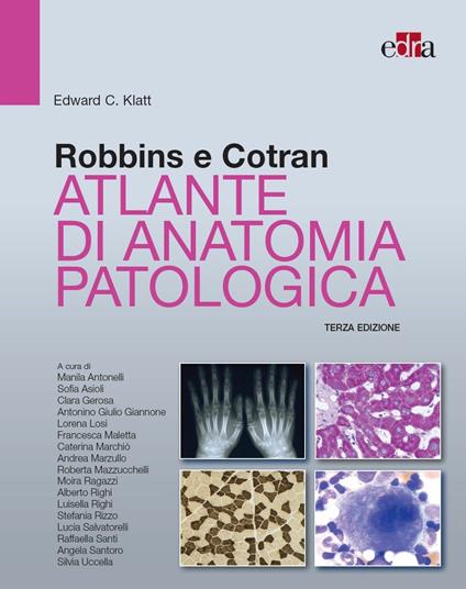 Robbins e Cotran. Atlante di anatomia patologica - Edward C. Klatt - ebook