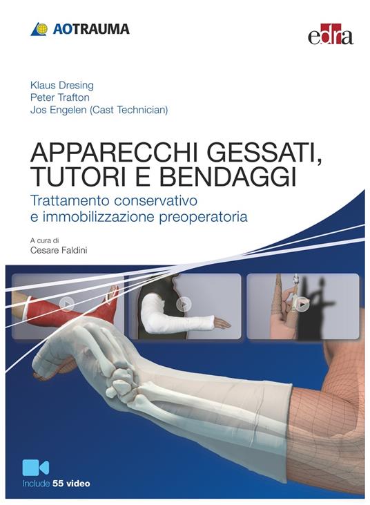 Apparecchi gessati, tutori e bendaggi. Trattamento conservativo e immobilizzazione preoperatoria. Con Contenuto digitale (fornito elettronicamente): 55 video - Klaus Dresing,Jos Engelen,Peter Trafton,Cesare Faldini - ebook