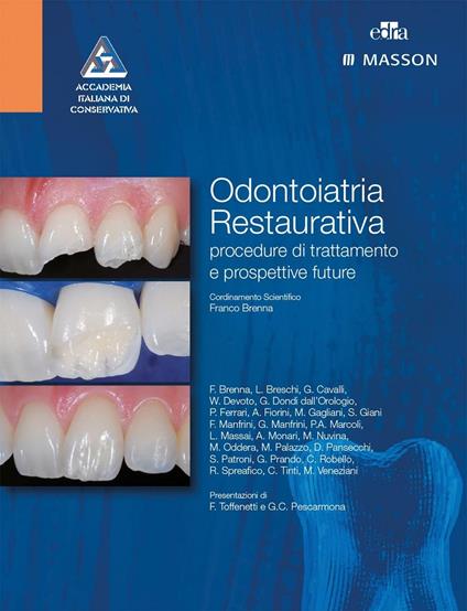 Odontoiatria restaurativa. Procedure di trattamento e prospettive future - Franco Brenna - copertina