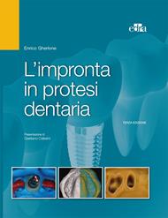 L' impronta in protesi dentaria