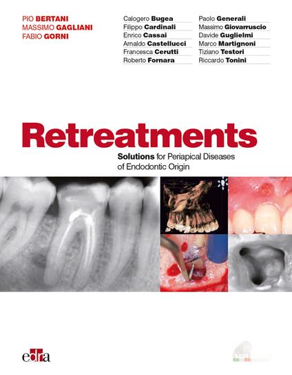 Ritrattamenti. Soluzioni per le patologie periapicali di origine endodontica - copertina