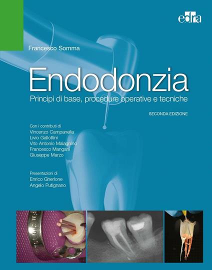 Endodonzia. Principi di base, procedure operative e tecniche - Francesco Somma - copertina