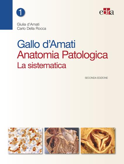 Gallo d'Amati. Anatomia patologica. La sistematica - Giulia D'Amati,Carlo Della Rocca - ebook